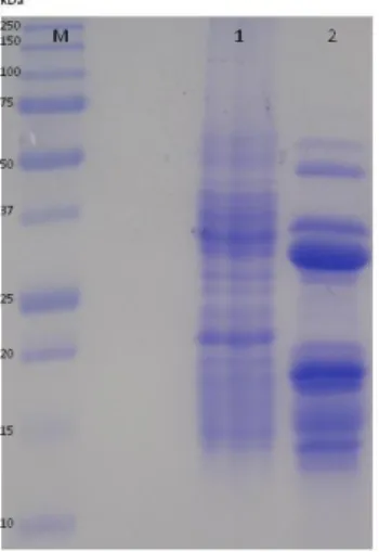 Figure 4. SDS-PAGE analysis. Polypeptide profile of β-conglutin after 1 month of degradation