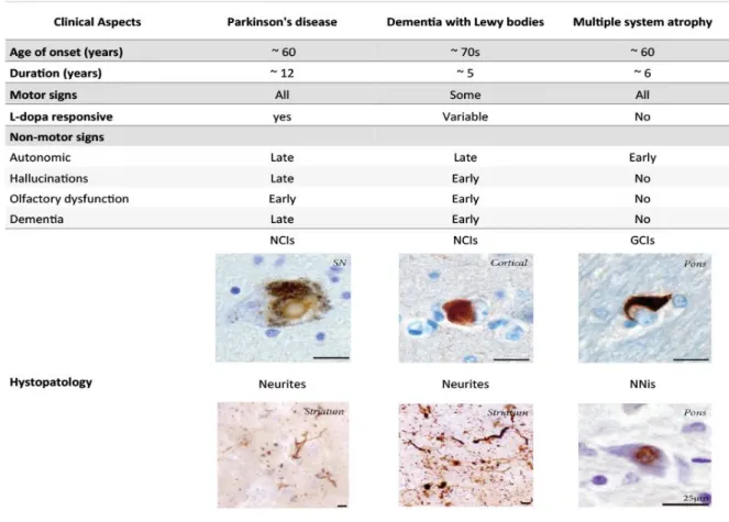 Figure  2.  Clinical  and  histopathological  hallmarks  of  the  three  main  Synucleinopathies