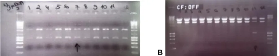 Fig. 3.12 – Confirmation of E. coli αDH5 transformation with constructed pYUB854. (A) pYUB854 with 5’ end of  Rv2488c (3.8 Kb plus 877 bp)