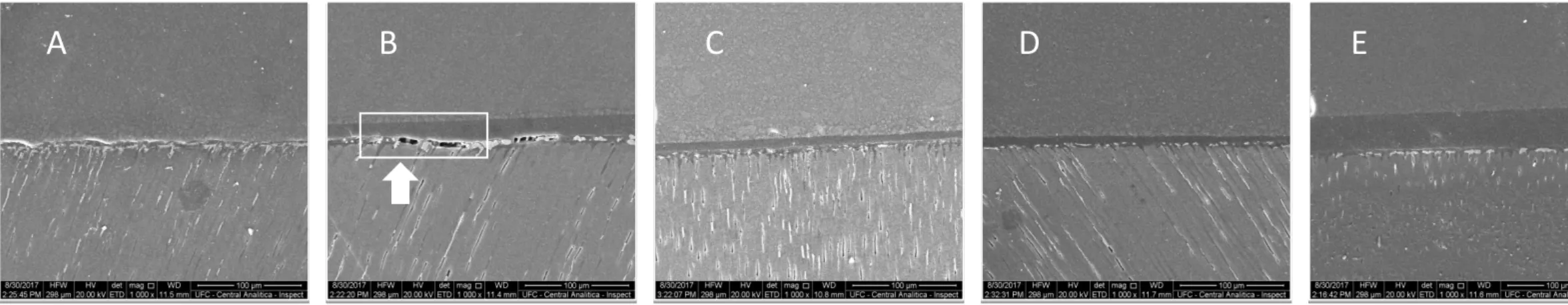 Fig. 3: Evaluation of the dentin / adhesive union interface after the use of dentin pre-treatments (A) WC, (B) AE, (C) EDC+AE, (D) GA+AE and  (E) PAC+AE, with nanoleakage being performed and analyzed by SEM in an increase of 1000X, where a great amount of 