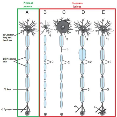 Figure 1.3: Neuronal patterns resulting from the chemicals action. A. Normal neuron; B