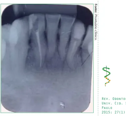 Figura 1: Radiografia periapical inicial.