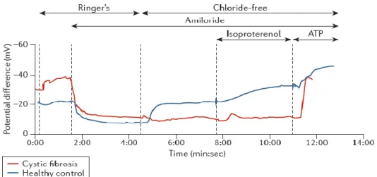 Figure  I.1.13  - Diagnosing  cystic  fibrosis:  nasal  potential  difference  measurement