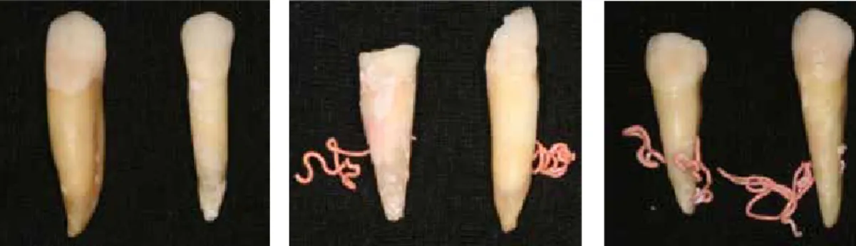 Figura 2. Imagens dos dentes obturados: A - condensação lateral; B - híbrida de Tagger; C -  condensação vertical de ondas contínuas.