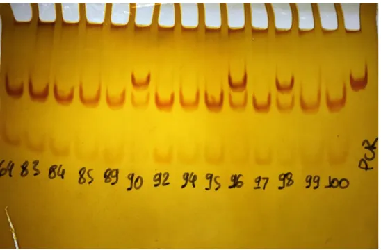 Figura 4  –  Gel de poliacrilamida de IL6