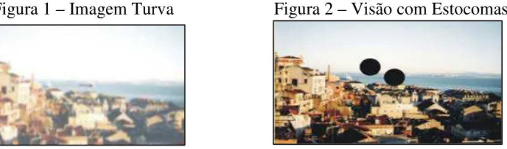Figura 3 – Visão em Túnel 