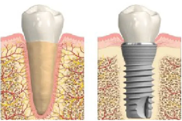Figura 1 - Diferença da interface do dente e do implante. Adaptado de (Albrektsson et al., 2017)