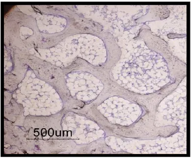 Figura 5. Tecido ósseo esponjoso constituído por trabéculas ósseas separadas por zonas de medula óssea  (Judas et al., 2012)