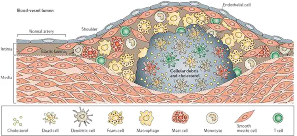 Figure 10 - Cellular composition of an atherosclerotic plaque. Image obtained from Hansson et al [33].