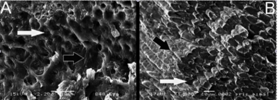 Figura 2- Imagens obtidas em microscopia de varrimento eletrónico para comparar prismas de  esmalte bovino (A) com humano (B) (Adaptado de Fonseca et al., 2008)