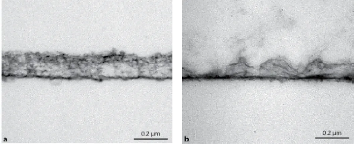 Figura 7- Imagens obtidas de microscopia de transmissão eletrónica para mostrar a capacidade  de proteção de uma película adquirida de 2horas (a), após sofrer um ataque ácido