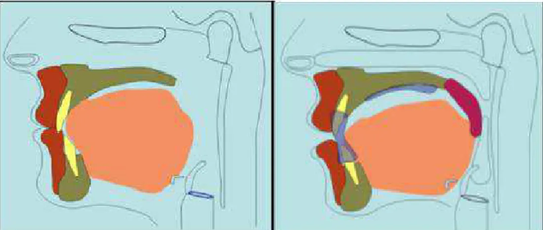 Figura 4: Posicionamento da língua e correto selamento labial na respiração nasal e posicionamento da  língua durante a respiração oral (adaptado de Engelke et al., 2011) 