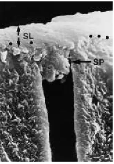 Figura 3 - SL- Smear layer; SP- Smear Plugs (Heymann et al., 2012)