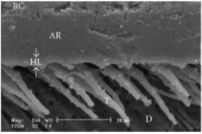 Figura 4 - Fotografia microscópica (1250x) da interface entre a resina e a dentina. RC- Resina  composta; AR- Adesivo; HL- Camada Híbrida; T- Resin Tags; D- Dentina  