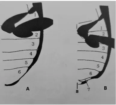 Figura  2  –  Vista  ventral  do  abdómen,  mostrando  o  número  de  esternitos  visíveis:  A)  6  esternitos  visíveis (mais comum); B) 8 esternitos visíveis (Género Brachinus)