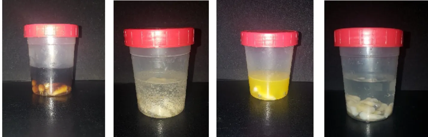 Figura 10 - Dentes imersos em Coca-Cola ® , 7 Up ® , Fanta ®  Laranja e Saliva artificial, respetivamente.