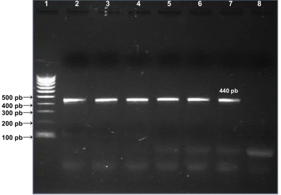 Figura 3. Análise electroforética do fragmento de 440 pb do gene hsp65. 