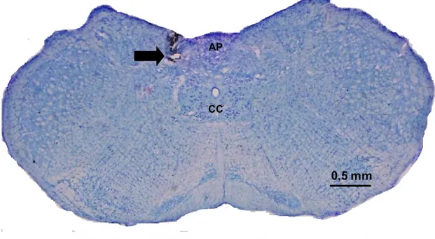 Figura 1: Fotomicrografia de um corte coronal do encéfalo de um rato representativo dos  grupos testados, mostrando o local da injeção unilateral, indicado pela seta, no núcleo do  trato solitário (NTS)