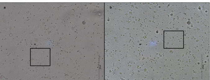 Figure  9  –  Morphological  differences  between  cerebellar  granule  cells  at  day  9  in  culture  (a)  under  control  conditions and (b) in the presence of 90 µM of glutamate