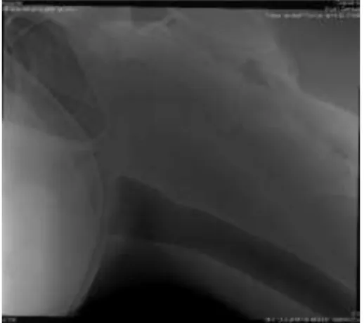 Figura 2. Raio X Lateral Direita. Fonte: Imagem  radiográfica cedida pela Dra. Claudia de Mello 