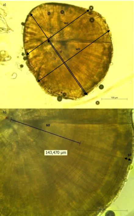 Fig. 2. Photograph of lapillus of a juvenile of Diplodus vulgaris (Total Length: 24 mm) viewed under light microscope