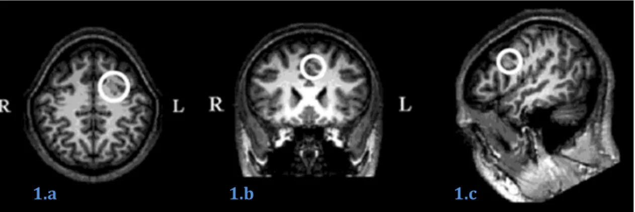 Fig   7.   Fotografía   del   la   regiones   del   cerebro.(   Fuente:   Berkowitz   2010.pag   139)       