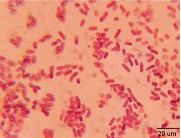 Figura  2.  Bactérias  do  gênero  Bacillus  spp.,  obtidas  da  rizosfera  de  bananeiras,  visualizadas em microscópio de luz (100x)