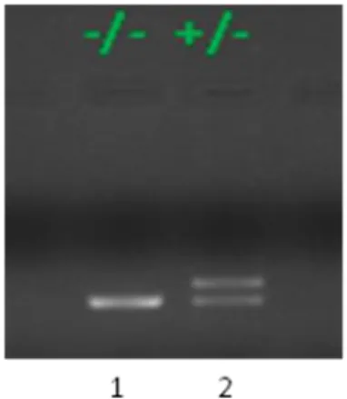 Figura  8  -  Fotografia  do  gel  de  agarose  onde  se  identifica  no  canal  1  (-/-)  a  homozigotia sem inserção e no canal 2 (+/-) a heterozigotia.