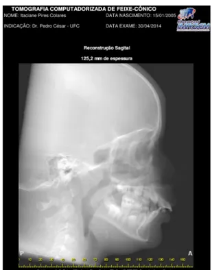 Figura 3- Radiografia panorâmica inicial.