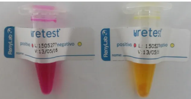 Figura  1  –  Teste  rápido  da  urease  com  resultado  positivo  apresentando  coloração  rósea,  e  resultado  negativo  apresentando coloração amarela