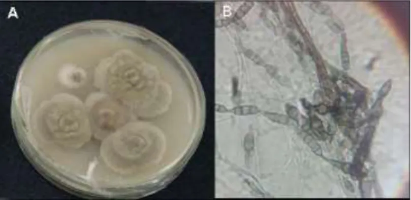 Figura  1.  Morfologia  da  colônia  de  A.  alternata  em  meio  de  cultura  BDA  após  (A)  uma  semana  de  crescimento  e  (B)  Microscopia  óptica  de  A