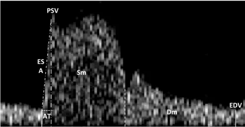 Figure 2. OA Doppler wavefront analyzed characteristics. ESA (early systolic acceleration)  represents  the  fastest  moving  portion  of  the  systolic  component