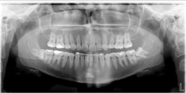 Figure 9: Patient 6 – Orthopantomography 