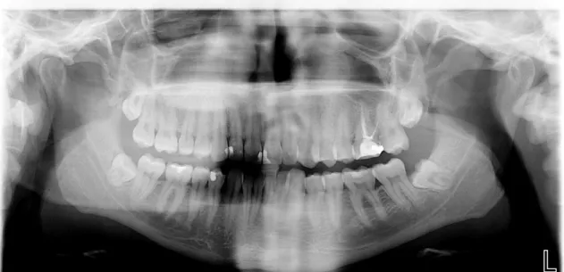 Figure 11: Patient 8 – Orthopantomography 