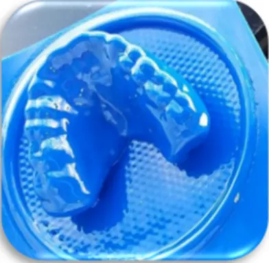 Figura 1. Protetor bucal (tipo III) confeccionado pelo Cirurgião Dentista  2.3 Procedimento Experimental: 