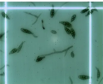 Figure 1. Conidia of  Alternaria  alternata produced after 21 days at 27ºC under constant  illumination on PDA medium