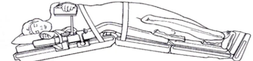 Figura 3: Posição Trendelenburg Lateral. Consiste no decúbito lateral, com o corpo inclinado  para o lado, pernas e pés conforme o nível de cabeça