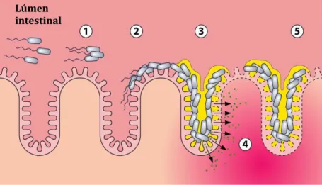 Figura 2  –  Estágios da progressão da patogênese da Escherichia coli enteroagregativa 