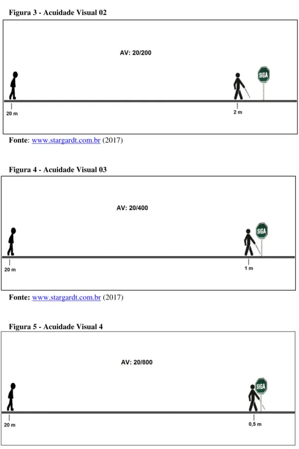 Figura 3 - Acuidade Visual 02 