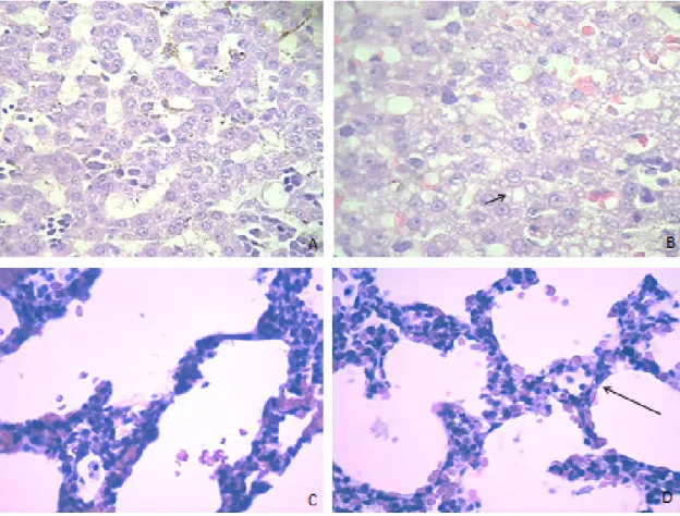 Fig.  9:  Fotomicrografias  dos  aspectos  histopatológicos  do  fígado  e  pulmão  dos  animais  sacrificados após o nascimento (H.E.)