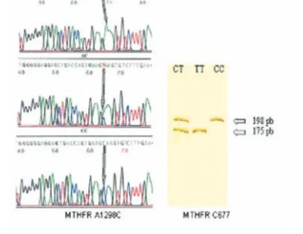 Figura 2. Polimorfismos do gene da MTHFR C677T Figure 2. Polymorphisms of the MTHFR gene