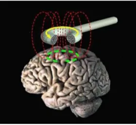 Figura 3.3 - Funcionamento da técnica de EMT, com o coil a enviar impulsos eletromagnéticos para a região do  cérebro sob ele [15] 