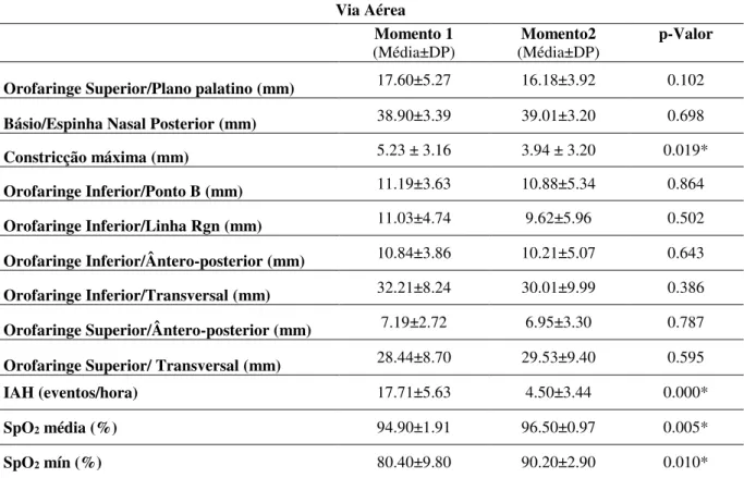 Tabela 2: Padrão de distribuição amostral pelo teste de normalidade de Shapiro-Wilk e análise por meio do   teste t pareado (dados paramétricos), quanto as medidas de via aérea, bem como valores do IAH, SpO 2  mín    e SpO 2  média