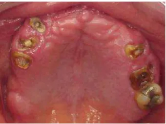Figure 1.  Initial aspect of the patient’s 
