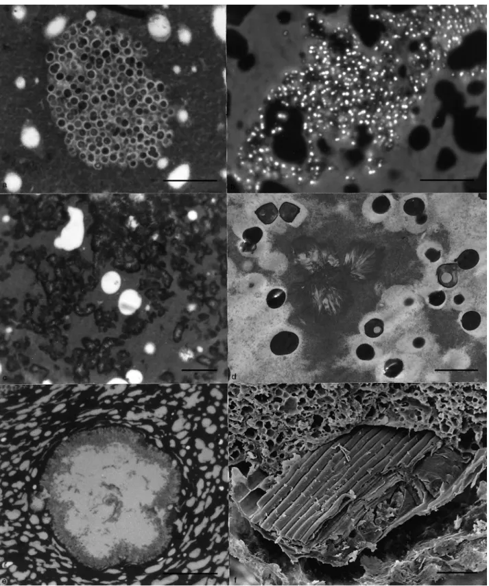 Fig. 3 (a) Colony of yeast cells in mid-region of soft cheese; light microscopy (LM), scale bar  10 mm