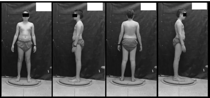 Figura 1. Posicionamento do aluno sobre a plataforma giratória para avaliação postural