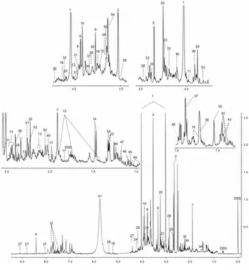 Figure 1.2 Several  1 H  NMR  urine  stud reviewed. Bouatra and co-aut human urine. These authors f reported  in  a  study  performed have  been  identified  and  eac These high-dimensional datas the  spectrum  and  the  integral procedure  reduces  the  t