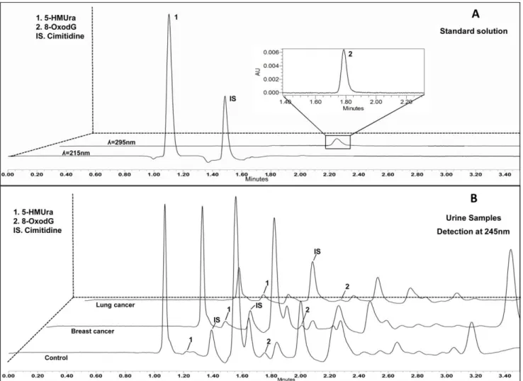 Figure 3. Representative UHPLC-PDA chromatograms of a biomarker standard solution (5-HMUra at 0.0025 mg mL 21 ; 8-oxodG at 4 mg mL 21 ) (A), and from urine of control subjects and cancer (lung and breast) patients (B).