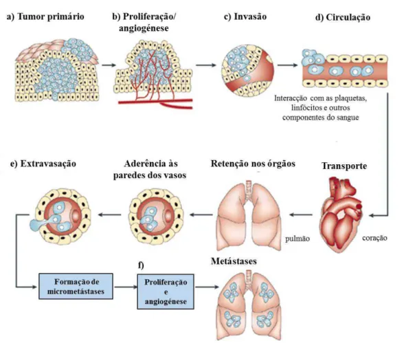 Figura  1  -  As  etapas  principais  do  processo  de  invasão  e  metastização  do  cancro:  a)  transformação  celular  e  crescimento  do  tumor  primário;  b)  angiogénese  promovida  pela  síntese  e  secreção de factores angiogénicos; c) invasão par