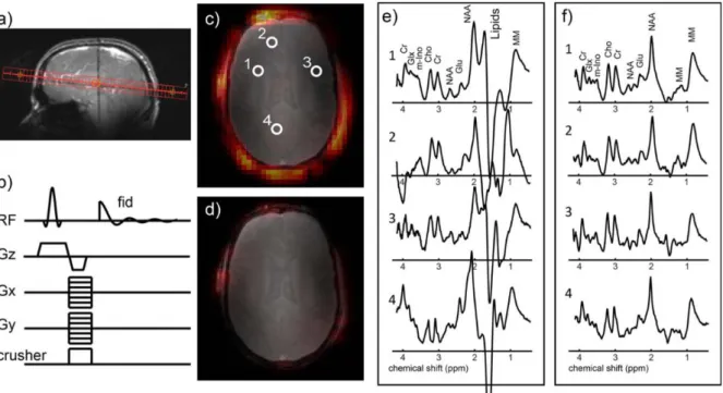 Figure  4. Example  of  1 H-MRSI  in  vivo data  acquisition  using  a  so-called  crusher  coil� 